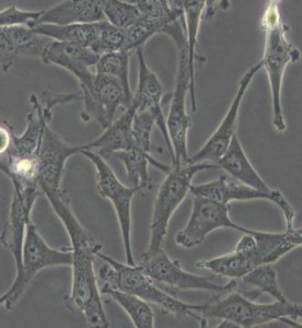 A172人膠質(zhì)母細(xì)胞瘤細(xì)胞主圖