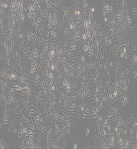 ACHN人腎細(xì)胞腺癌細(xì)胞主圖