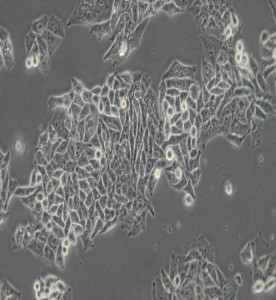 BEL-7402人肝癌細胞主圖