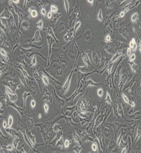 BT-549人乳腺管癌細(xì)胞主圖