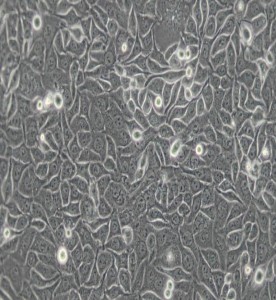 CNE-2Z人鼻咽癌細胞主圖