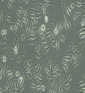 CNE人鼻咽癌細胞主圖