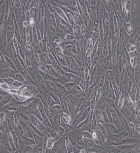 EA.hy926人臍靜脈細(xì)胞融合細(xì)胞主圖