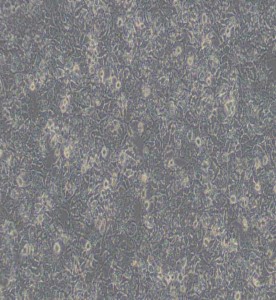 HuH-7人肝癌細胞主圖