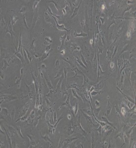 HULEC-5a人肺微血管內皮細胞主圖