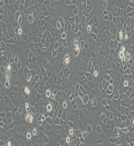 Ishikawa人子宮內(nèi)膜癌細胞主圖