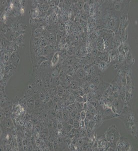 JAR人胎盤絨毛癌細胞主圖