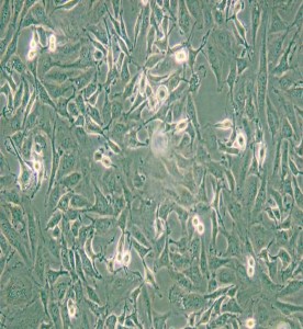 KTC-1人甲狀腺癌細胞主圖