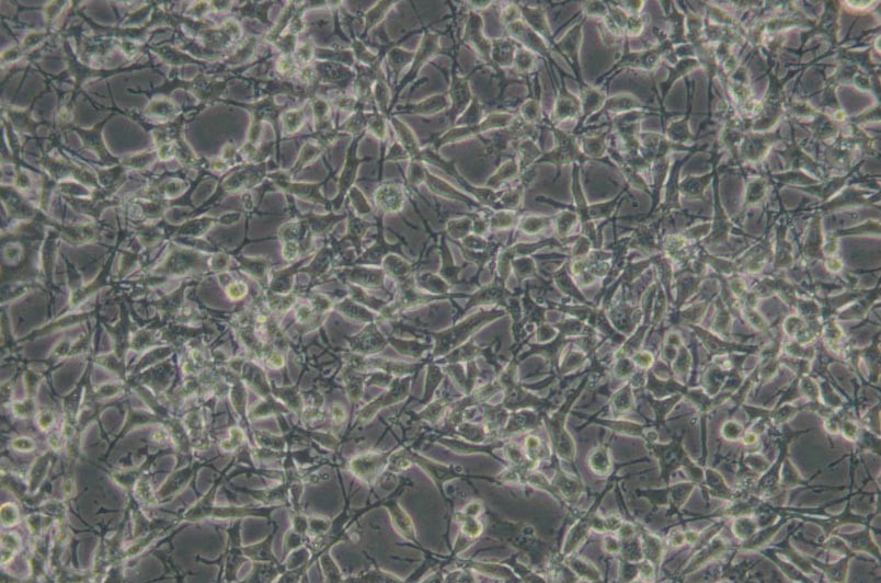 K7M2-WT小鼠骨肉瘤成骨細胞主圖