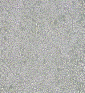 AE-1小鼠雜交瘤細胞(抗AChE)主圖