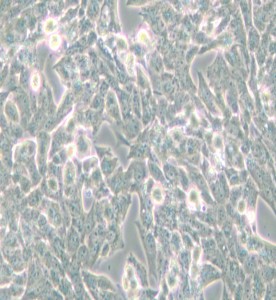 NCI-H295R人腎上腺皮質(zhì)腺癌細胞主圖