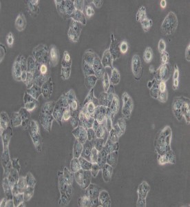 NCI-H1299人非小細胞肺癌細胞主圖