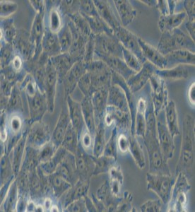 NCI-H1703人肺鱗癌細胞主圖