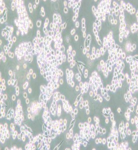 B95-8絨猴EB病毒轉化的白細胞主圖