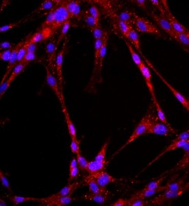 大鼠肺大動脈內皮細胞主圖