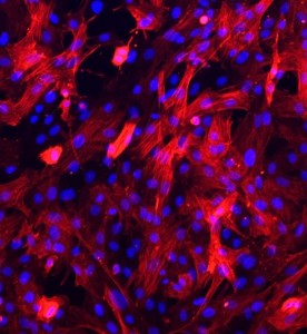 大鼠主動脈平滑肌細胞主圖
