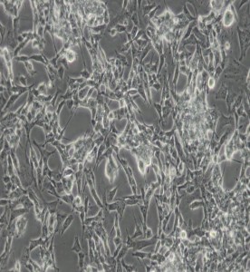 SK-N-BE(2)人神經(jīng)母細胞瘤細胞主圖