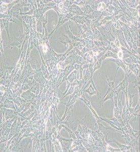 Hey人卵巢癌細胞主圖