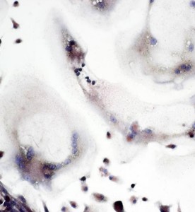 大鼠破骨細胞主圖