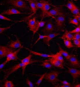 大鼠骨髓來(lái)源內(nèi)皮祖細(xì)胞主圖