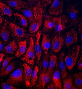 大鼠牙齦上皮細胞主圖