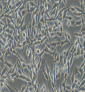 RKO-AS45-1人結腸癌轉基因細胞主圖