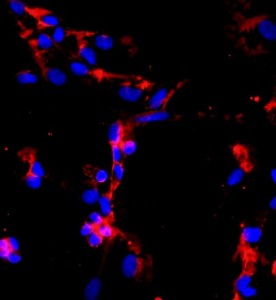 人肺微血管內(nèi)皮細胞主圖