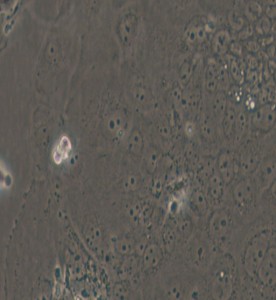 SW1463人大腸癌細胞主圖