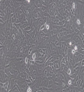 U-2OS人骨肉瘤細胞主圖