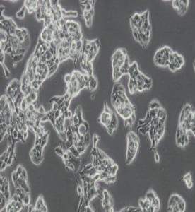 ZR-75-1人乳腺癌細(xì)胞主圖