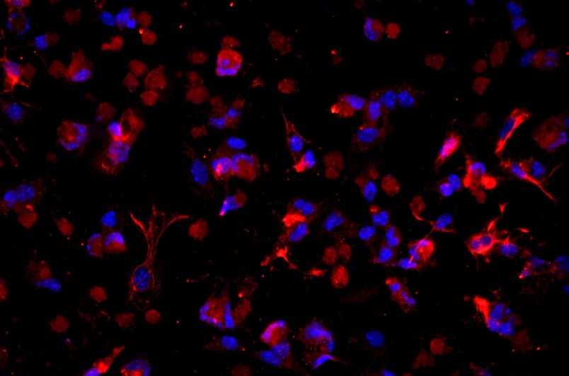 小鼠肝星狀細胞主圖