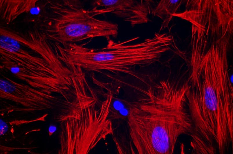 小鼠子宮平滑肌細(xì)胞主圖