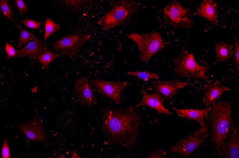 小鼠卵巢上皮細胞主圖