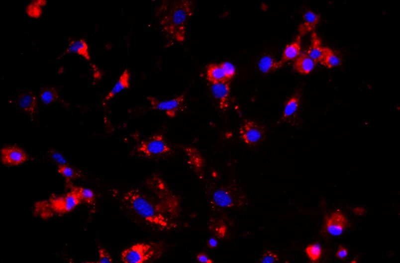 小鼠腎小球內皮細胞主圖