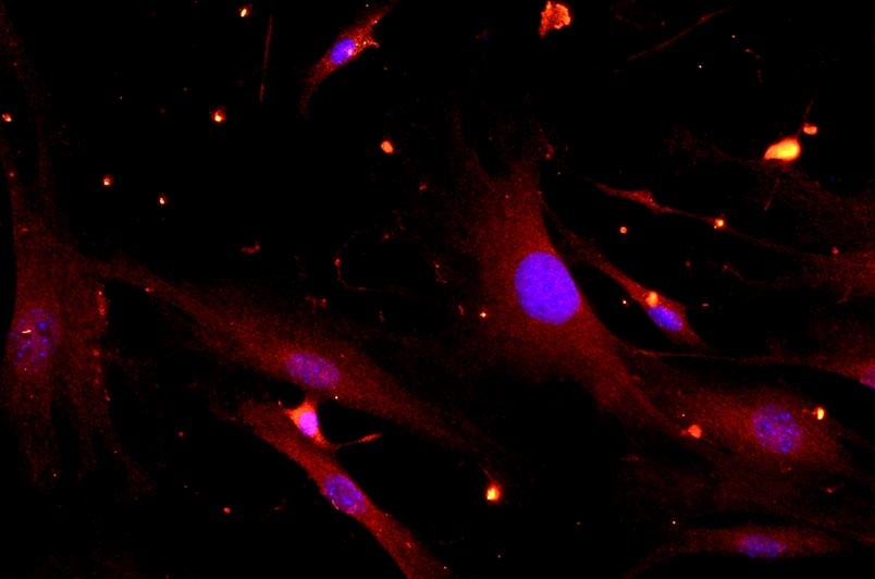 小鼠滑膜細胞主圖
