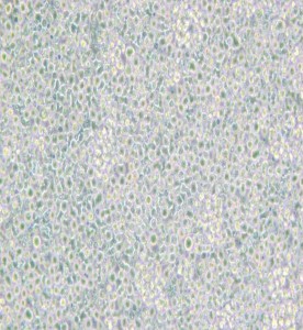 BeWo人絨毛膜腫瘤細胞主圖