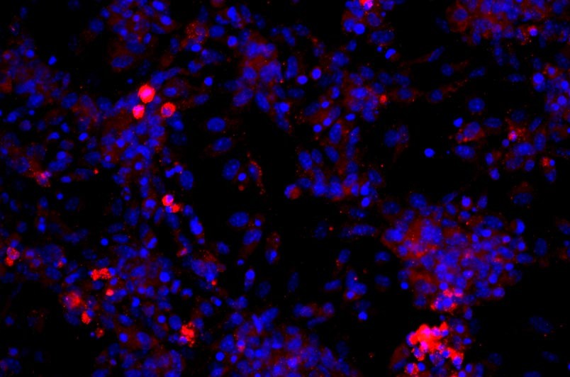 小鼠真皮微血管內皮細胞主圖