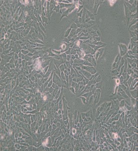 MDA-MB-361人乳腺癌細(xì)胞(L15) 主圖