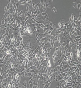 MDA-MB-415人乳腺癌細胞(L15) 主圖