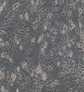 MDA-MB-435S人乳腺癌細胞/人黑素瘤細胞(M14污染細胞系)主圖