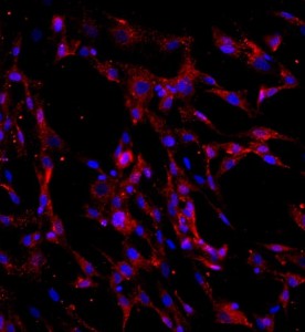 人骨髓間充質干細胞主圖